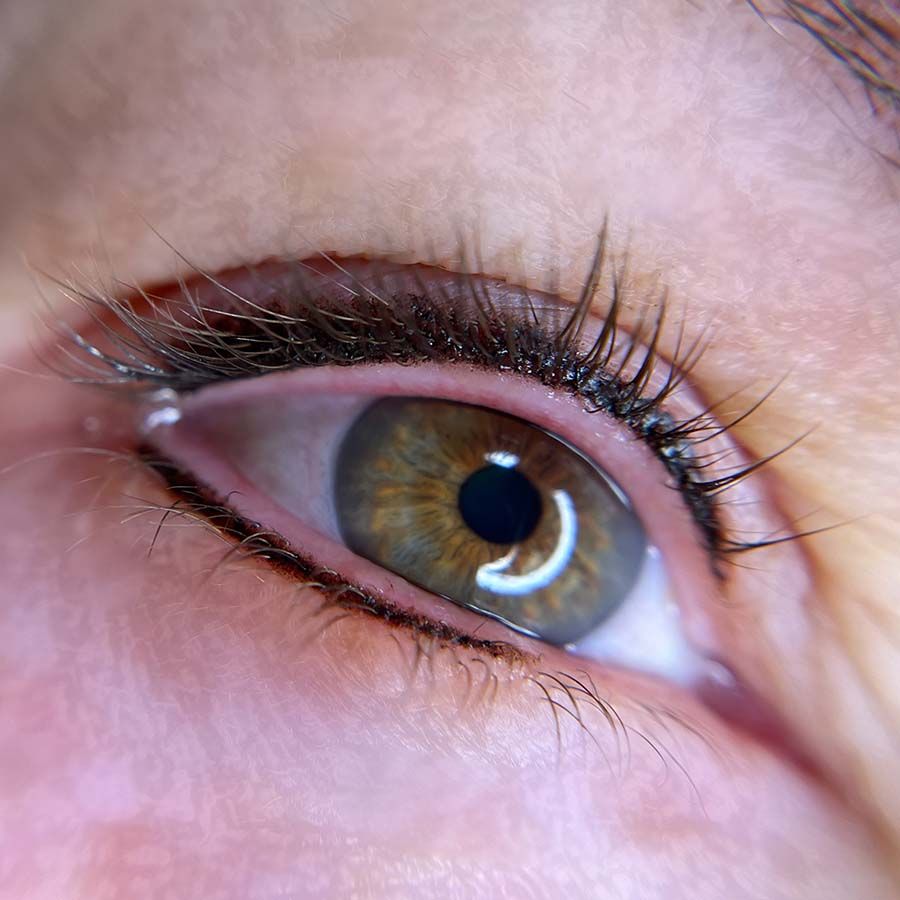Lash enhancement